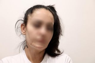 Głos w sprawie zabrała rodzina rannej Pauliny. Dziewczyna walczy o życie po wypadku na Trasie Łazienkowskiej