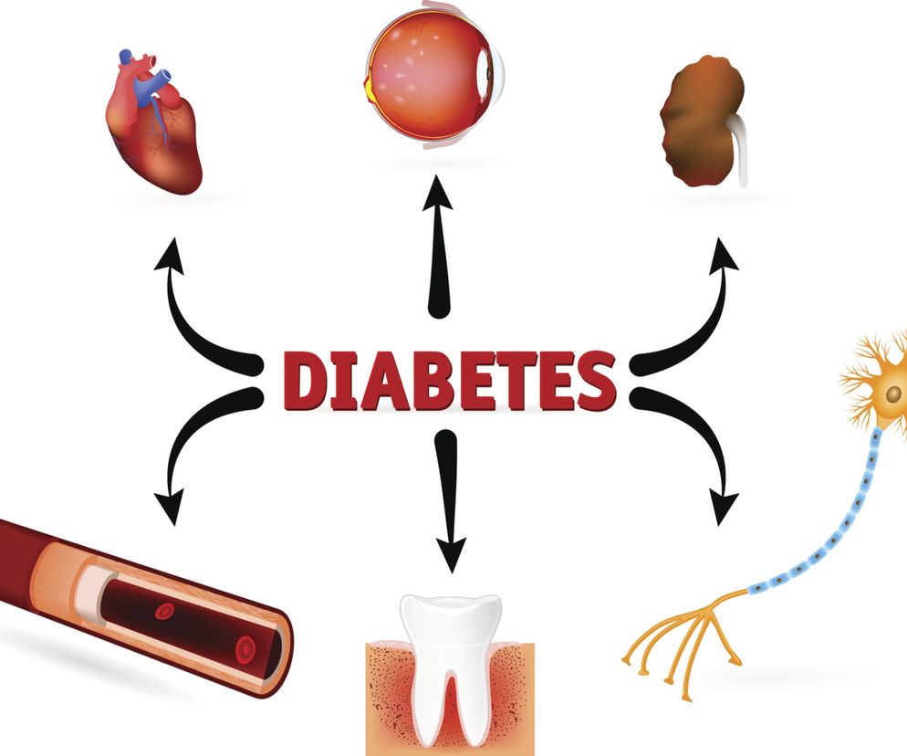 Cukrzyca - POWIKŁANIA wczesne i późne
