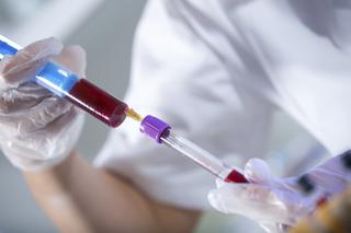 Badania biochemiczne krwi: kiedy powinnaś je wykonać?