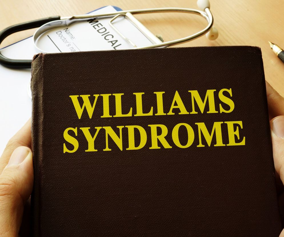 Zespół Williamsa (dzieci elfy) jest to zespół wad genetycznych spowodowanych mutacją w obrębie chromosomu 7.