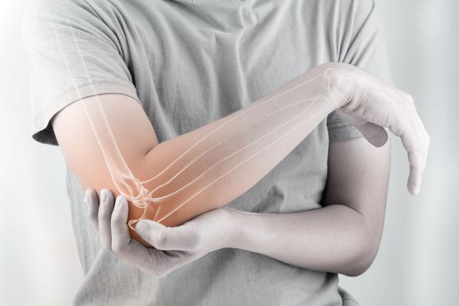 Czym różni się artretyzm od osteoartretyzmu?