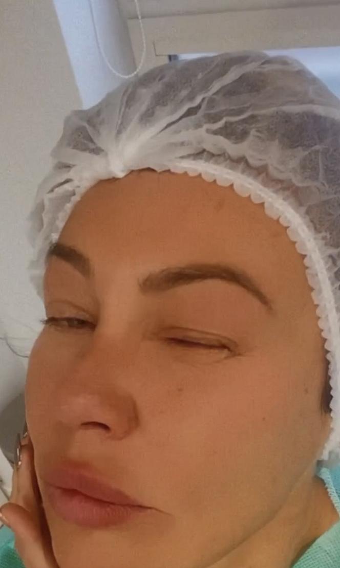 Monika Jarosińska przeszła operację by lepiej widzieć