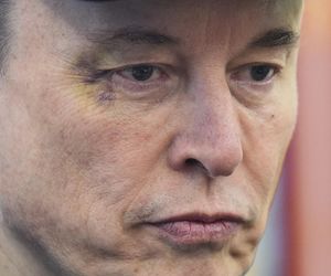 Elon Musk w Białym Domu z podbitym okiem 