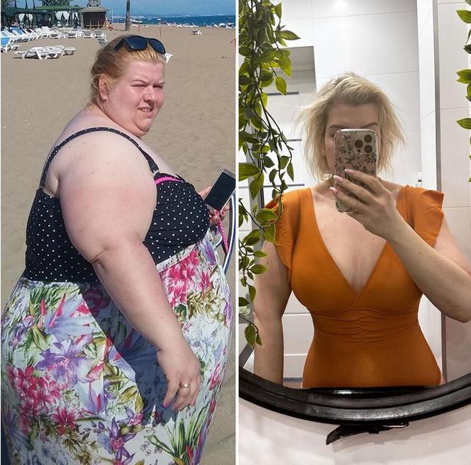 Kasia Guzik Schudła 100 Kilogramów Gwiazda Internetu Pokazuje Zdjęcia I Zdradza Jak To Zrobiła 9931