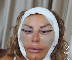 Dagmara Kaźmierska miała operację plastyczną