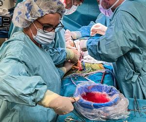 Retransplantacja serca i przeszczepienie nerki
