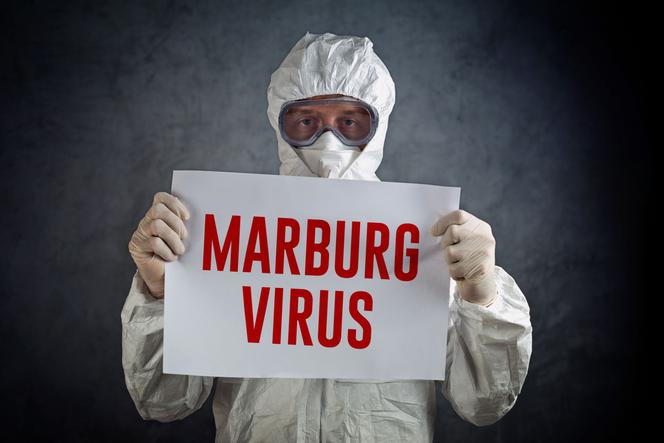 Gorączka krwotoczna Marburg - przyczyny, objawy, leczenie