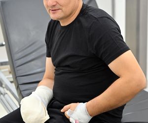 Lekarze z 5 Wojskowego Szpitala Klinicznego w Krakowie przyszyli oderwany kciuk panu Wojciechowi