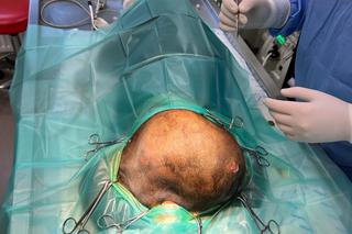 Weterynarze wycięli Zuzi gigantycznego guza