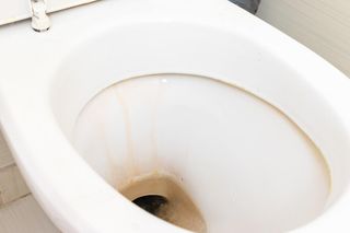 KAMIEŃ w SEDESIE: jak usunąć kamień z toalety? SPRAWDZONE SPOSOBY