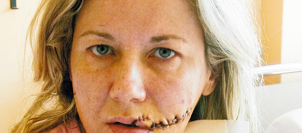 To mąż zmasakrował mnie żyletką