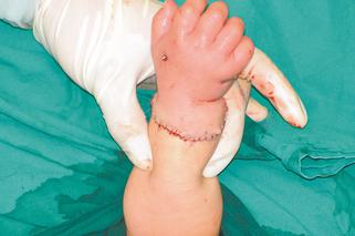 Babcia obcięła wnuczce rączki!