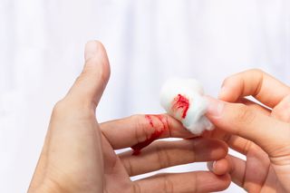 Hemostaza - przebieg. Zaburzenia hemostazy