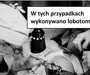 W tych przypadkach stosowano lobotomię