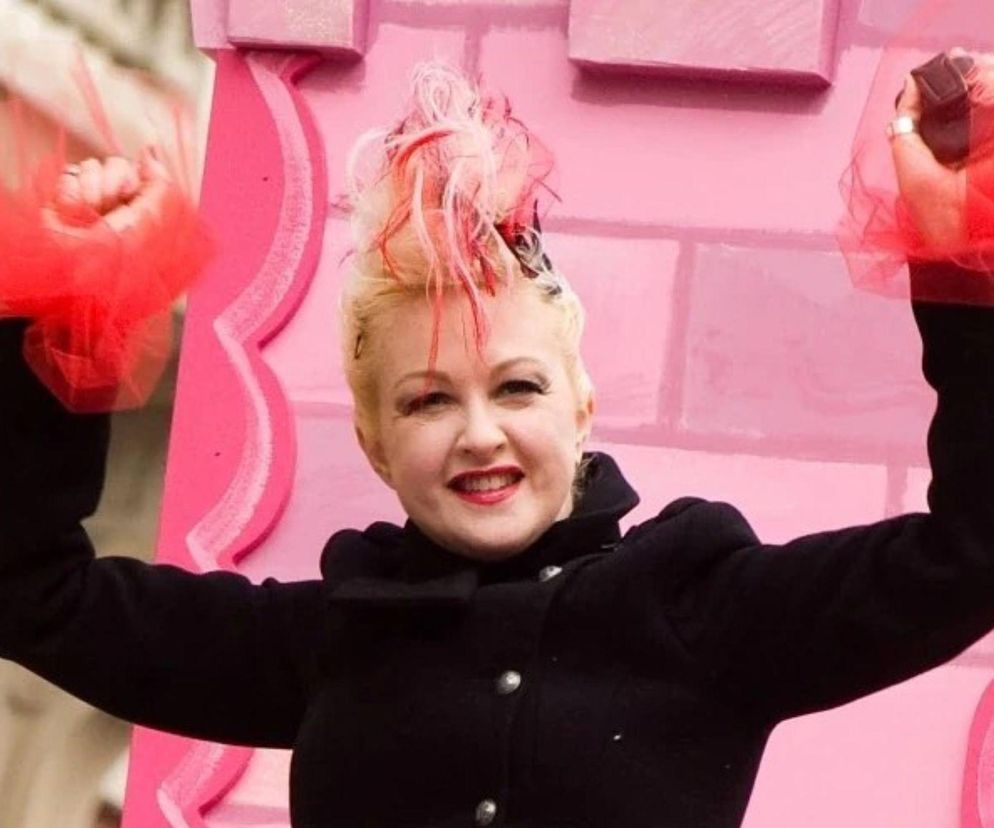 Cyndi Lauper szczerze o swojej chorobie. Wyglądałam, jakby mnie oblano wrzątkiem