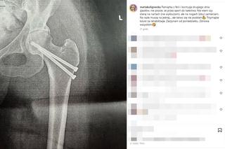 Gwiazda TVN24 miała wypadek na nartach. Marta Kuligowska musi przejść rehabilitację