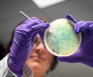 Bakterie żyją w nas: dobre i złe bakterie w organizmie człowieka