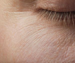 Objaw zgniłego jabłka zobaczysz na skórze. Na szczęście łatwo go zwalczyć