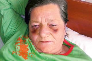 OPARZNO. Maria Tokarska i jej wnuk cudem przeżyli napad: SĄSIEDZI TORTUROWALI nas całą noc ZDJĘCIA