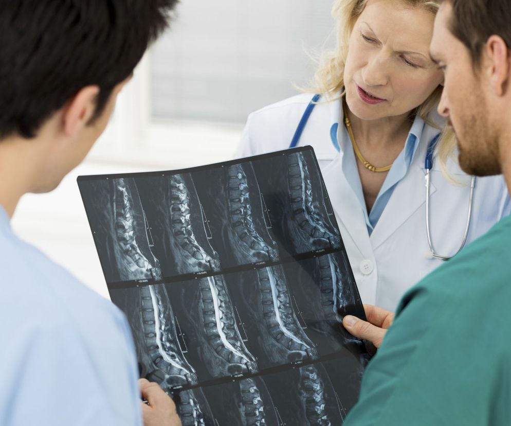 Jamistość rdzenia kręgowego to choroba neurologiczna, która może doprowadzić m.in. do niedowładu kończyn czy zaburzeń połykania i mowy.