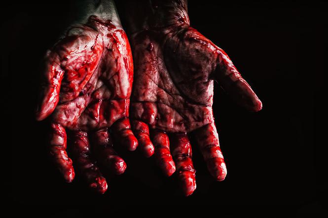 Krew, dłonie, ręce