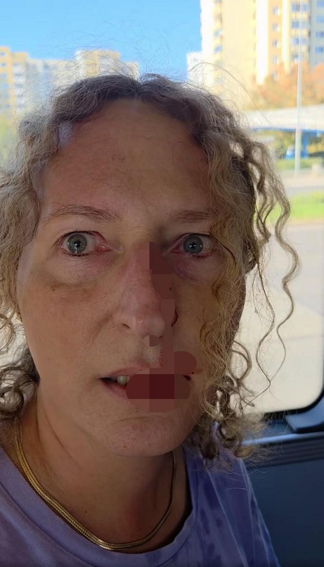 Zenobia broniła Ukrainki w autobusie w Warszawie. Została zaatakowana. „Krew polała się z nosa”