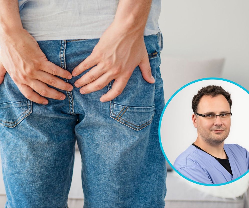 Torbiel pilonidalna to częsty problem, o którym mało się mówi. Jedynym ratunkiem jest operacja