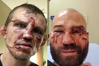 Krwawa jatka byłych fighterów UFC! Pokazali zmasakrowane twarze po walce na gołe pięści [ZDJĘCIA]