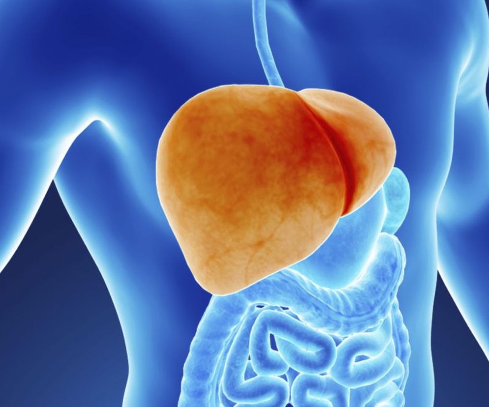 Dieta w chorobie, jaką jest stłuszczenie wątroby, to obecnie najskuteczniejsza metoda leczenia tego schorzenia. Odpowiednio skomponowany plan żywieniowy pozwoli nie tylko złagodzić objawy stłuszczenia wątroby, lecz także zlikwidować przyczyny choroby. Sprawdź, jak wygląda dieta na stłuszczoną wątrobę.