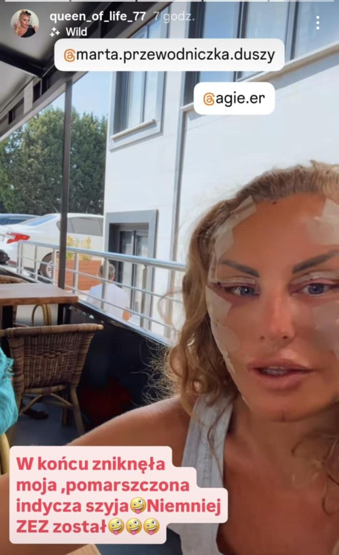 Dagmara Kaźmierska po operacji twarzy