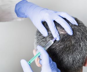 Moje włosy przestają się kręcić. Czy możliwa jest zmiana struktury włosa? [Porada eksperta]