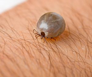 Bartoneloza - objawy, diagnostyka, leczenie