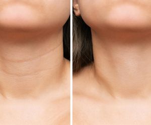 Działa jak profesjonalny zabieg, a zrobisz go za darmo. Najlepszy sposób na zmarszczki na szyi