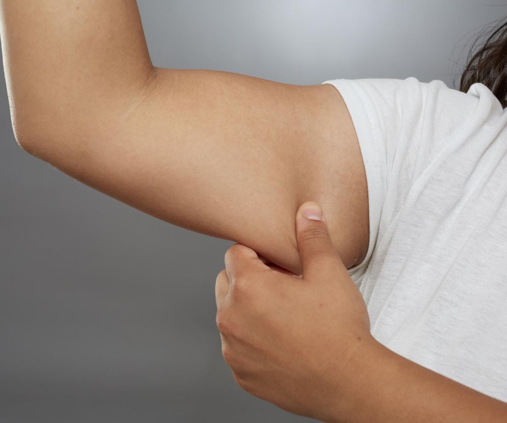 Odkryto nowy czynnik ryzyka demencji. Ma związek ze składem ciała