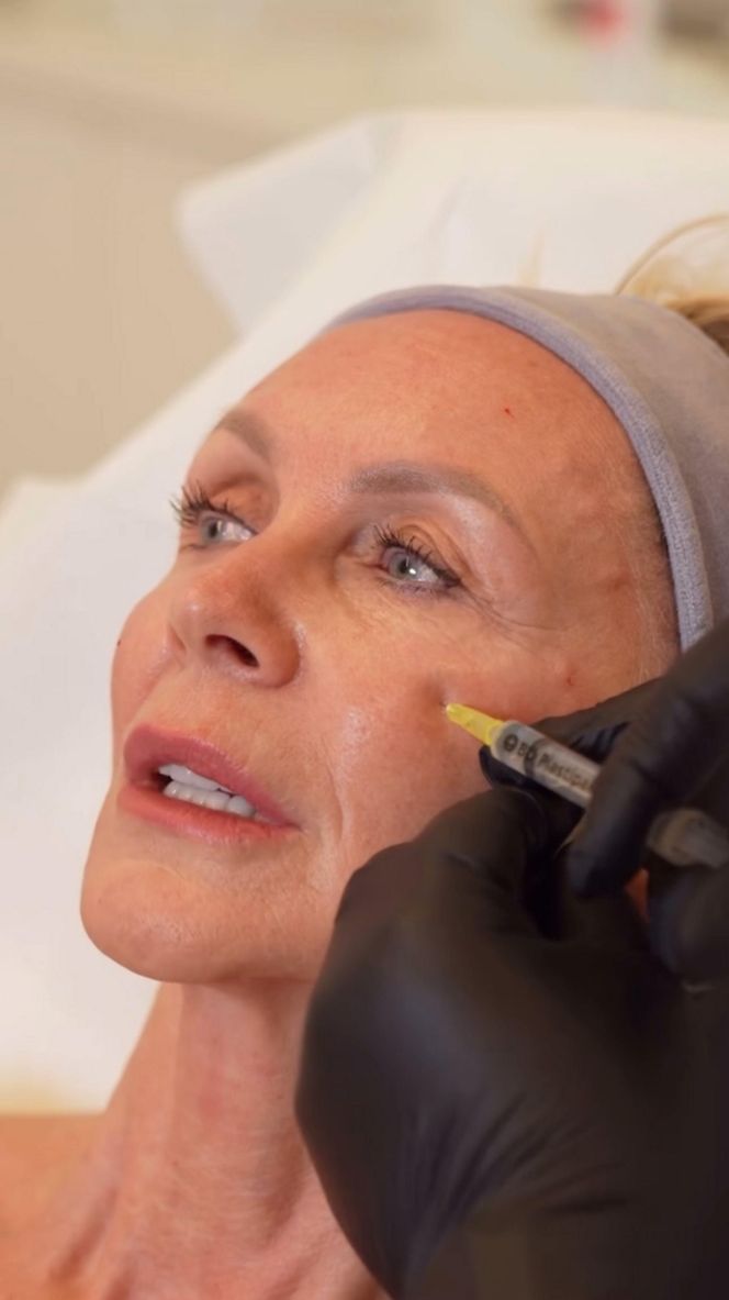 Jenningsowie kontra Alzheimer (BBC Earth)