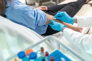 Czym są zespoły mieloproliferacyjne? Na liście aż 8 rodzajów nowotworów