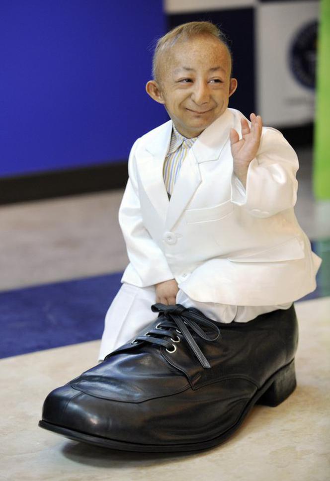Miniature Marvel: World's Tiniest Boy Fits Inside a Shoe