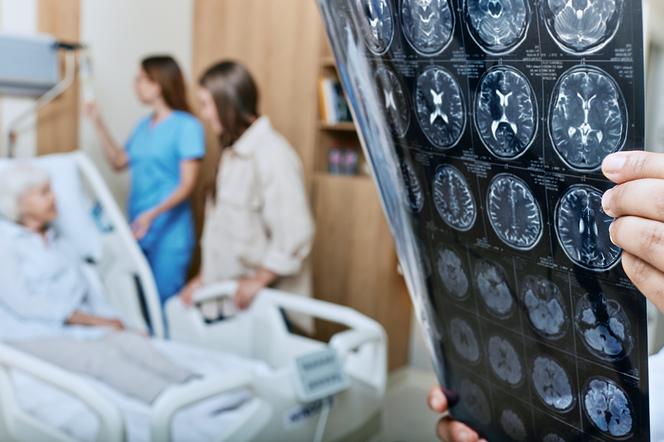 Polska naukowczyni odkryła lek na alzheimera? 5 tys. razy skuteczniejszy i mniej toksyczny