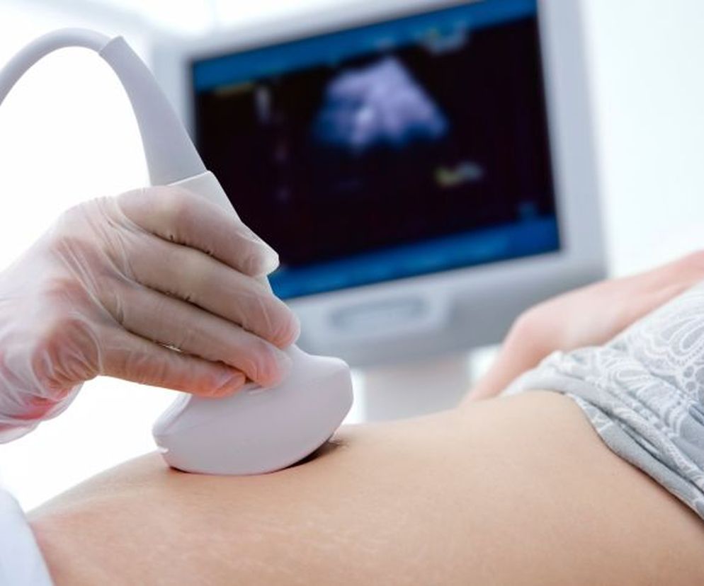 Ręka w białej rękawiczce trzyma głowicę USG, przykładając ją do brzucha leżącej kobiety, co symbolizuje badanie prenatalne. W tle widoczny jest monitor z obrazem płodu. Artykuł na Poradnik Zdrowie wyjaśnia cel i przebieg USG genetycznego płodu, które pozwala wykryć wady genetyczne.