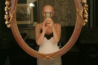 Chora dziennikarka Dzień dobry TVN pokazała zdjęcie bez włosów. Żarty z polską służbą zdrowia się skończyły 