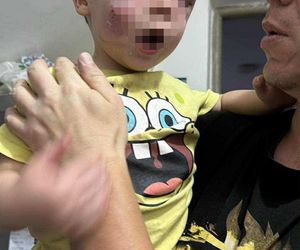 Pies pogryzł 3-latka na przystanku