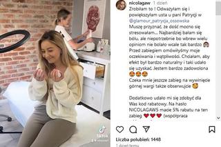 Nicola z Rolnik szuka żony powiększyła sobie usta