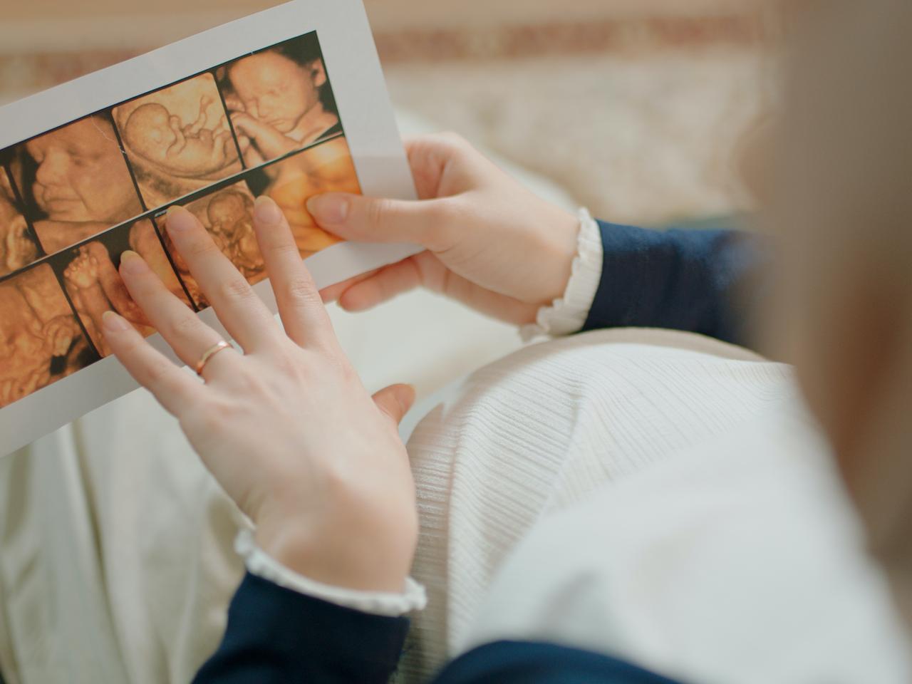 Jest teraz wielkości borówki, czy może już melona? Obrazowo pokazujemy, jak rośnie dziecko