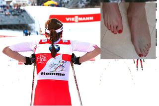 Soczi 2014. Justyna Kowalczyk ma problem - boląca stopa może zmazać marzenia o medalu!