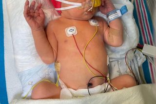 Serduszko Teosia nie ma siły bić