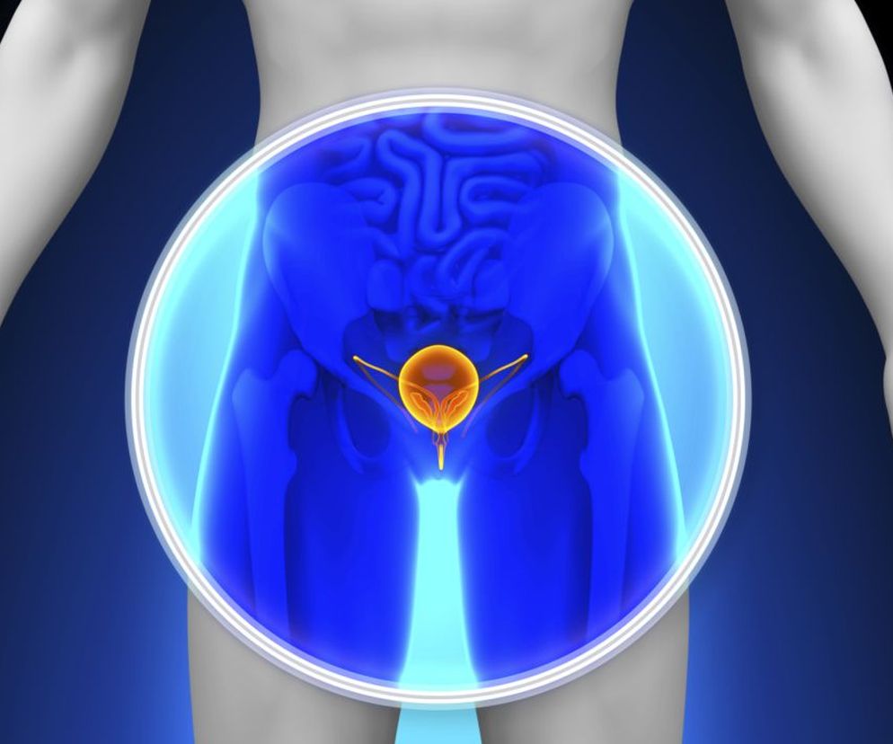Refluks pęcherzowo-moczowy pierwotny spowodowany jest wrodzoną nieprawidłowością budowy zwieracza, wtórny - złą pracą układu moczowego.