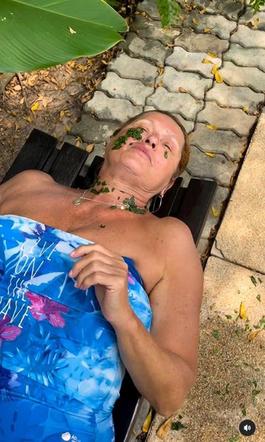 Ewa Kasprzyk poparzona przez meduzę