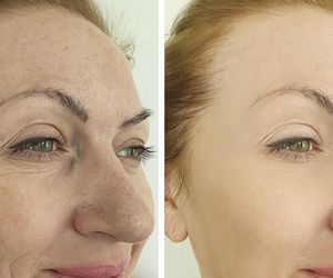 Domowy lifting w 30 minut. Wystarczy jeden składnik, by osiągnąć efekt WOW