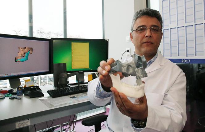 Wydrukowali mu nowe kości twarzy