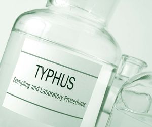 Tyfus (dur)